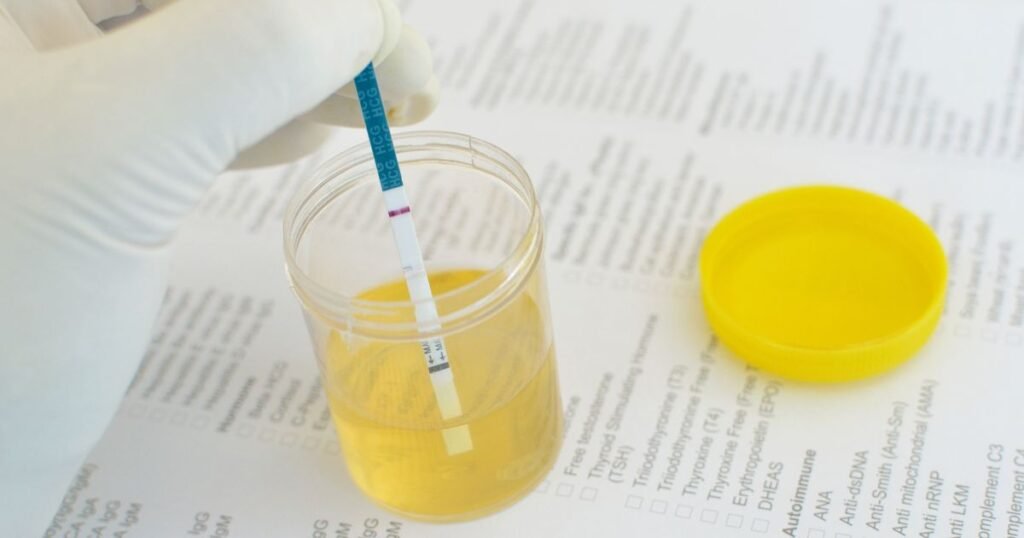 Urine Test for Pregnancy